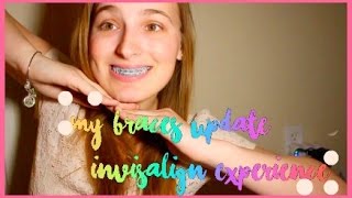 BRACES Update Invisalign Experience ♡ [upl. by Nylak907]