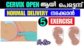 Cervix Open ആവാനും NORMAL DELIVERY ആവാനുള്ള Tips 9 Month Normal Delivery Exercise [upl. by Ardyce]