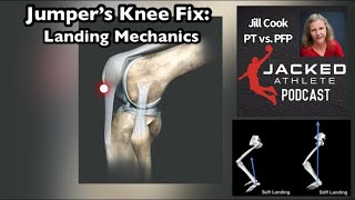 Jumper’s Knee Landing Mechanics Fix Patellar Tendon Pain [upl. by Lotz240]