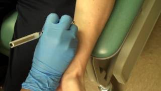 Allergy Testing Step 1 Skin Prick Testing [upl. by Zetta]