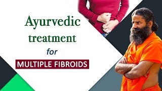 Ayurvedic Treatment for Multiple Fibroids  Swami Ramdev [upl. by Lekim]