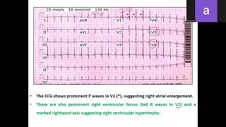 Pediatric Cardiology Mcqs amp Cases Part 2  072024 [upl. by Weywadt]