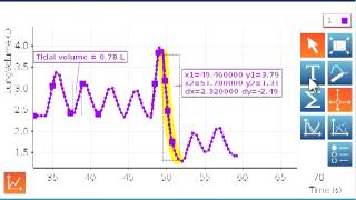 Spirometer Part 2 [upl. by Ario]