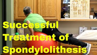 Successful Spondylolisthesis Treatment Without SurgeryLive Active amp PainFree [upl. by Williamson241]