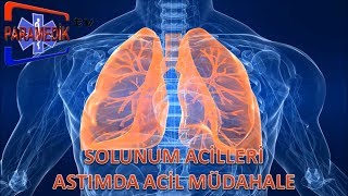 SOLUNUM Acilleri  Astım Krizinde Acil Müdehale Nasıl Olmalıdır [upl. by Adnorrehs921]