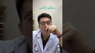 ยา Risperidone part22 เทรนด์วันนี้ antipsychotics schizophrenia จิตเภท ซึมเศร้า [upl. by Alokin]