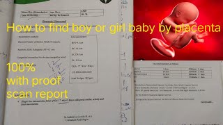 My boy amp girl baby placenta position with scan reportHow to identify boy scan report posterior [upl. by Schweiker]