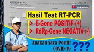 Cara Membaca Hasil Tes RTPCR Corona PCR real Times  RdRp gene Positif N gene Positif [upl. by Auahsoj]