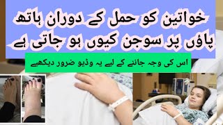 ECLAMPSIA Treatment Definition Etiology and Symptoms with DOCTOR ABIDA in HOMEOPATHY [upl. by Rheta]