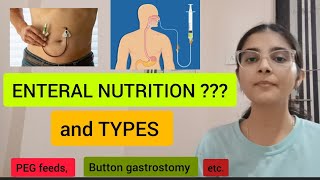 ENTERAL nutrition and its TYPES intro to parenteral nutrition MODES OF FEEDING [upl. by Suoinuj]