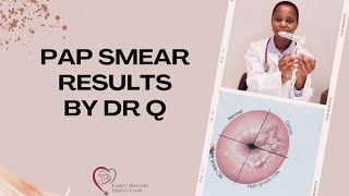 Explaining Pap Smear Results [upl. by Beeck]