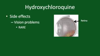 Hydroxychloroquine for Rheumatoid Arthritis [upl. by Audi]