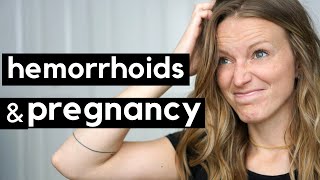 Hemorrhoids and Pregnancy [upl. by Demetri]