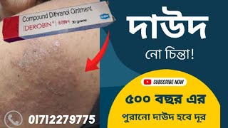 দাউদেরদাদ ও চুলকানির সবচেয়ে ভালো ঔষধ ডেরোবিনडेरोबिन क्रीम किस काम में आता है  দাদের ওষুধ Derobin [upl. by Olinde724]