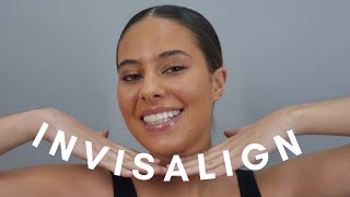 MY INVISALIGN EXPERIENCE [upl. by Fabriane638]