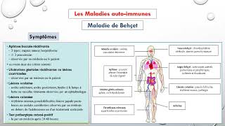 La maladie de Behcet [upl. by Ellinger]