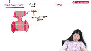 Acute Inflammation Part1 Pathology Hindi Lectures [upl. by Rigby464]