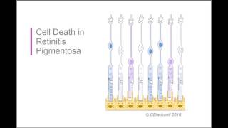 Retinitis Pigmentosa 2 Biology [upl. by Sacram]