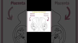 Why Your Placenta Location Matters [upl. by Haberman]