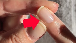 How to remove a hangnail like a PRO Pro Nail Technician Explains [upl. by Lidda]