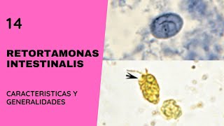 Retortamonas Intestinalis 14  Parasitosis  Flagelados [upl. by Nnahgiel]