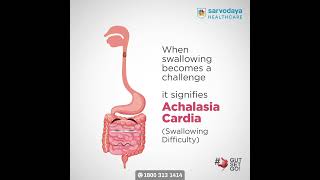 GutSetGo  Understanding Achalasia Cardia [upl. by Fenelia]