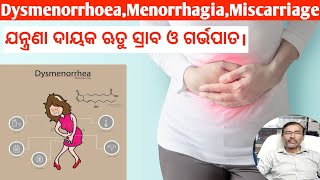 ଯନ୍ତ୍ରଣା ଦାୟକ ଋତୁ ସ୍ରାବ ଓ ଗର୍ଭପାତ।  Dysmenorrhoea Menorrhagia Miscarriage Homoeopathic Medicine [upl. by Ynohtnad]