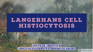 Langerhans Cell Histiocytosis [upl. by Terrab]