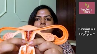 Menstrual Cup and IUD or Copper T priyankanjain coppert [upl. by Harle590]