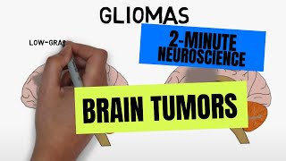 2Minute Neuroscience Brain tumors [upl. by Llennol]