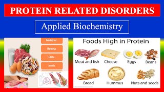 PROTEIN RELATED DISORDERS  Applied Biochemistry  For BSC Nursing [upl. by Eioj]