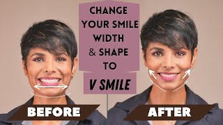 How to CHANGE Your SMILE Width and Shape to V SMILE [upl. by Centeno]