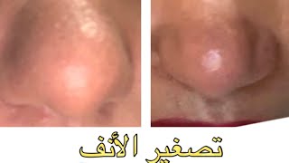 plasmapen fibroblast plaxel تصغير الأنف بدون عملية جراحية [upl. by Lorrad]