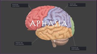 Brocas or Wernickes Aphasia on the NPTE [upl. by Eelahs]