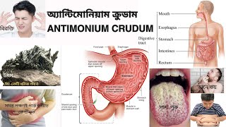 07 Antimonium Crudum l এন্টিমোনিয়াম ক্রুডাম l Materia Medica l Learn Antimonium Crudum easily [upl. by Ahseia]