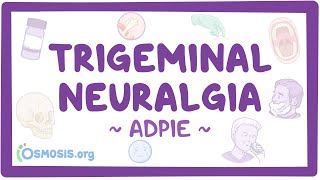 Trigeminal neuralgia Nursing Process ADPIE [upl. by Edi330]