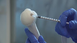 Chicago scientists develop revolutionary cartilage regeneration technology [upl. by Lorain]