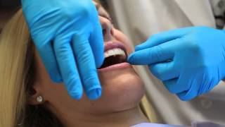 Instructions for Using a Teeth Whitening Strip  Dental Health [upl. by Flodur]