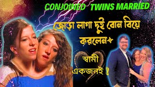 Conjoined twin sister abby and brittany hensel got marriedজোড়া লাগা দুই বোন বিয়ে করলেন স্বামী একজনই [upl. by De Witt]