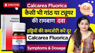 किसी भी गांठ टयूमर और सिस्ट की एक दवा  Calcarea Fluorica Homeopathic Medicine  Calcarea Flour 6x [upl. by Halak]