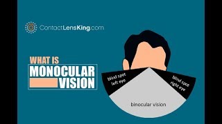 Monocular Vision Impairment and How it Impacts Depth Perception [upl. by Innus]