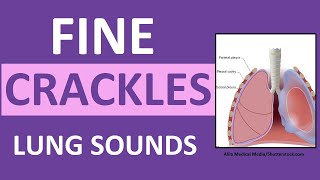 Crackles Fine Lung Sounds  Crackles and Rales Breath Sounds Abnormal [upl. by Blair540]