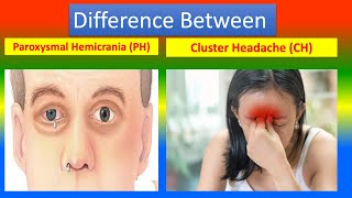 Difference Between Paroxysmal Hemicrania and Cluster Headache [upl. by Aihsatan266]