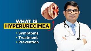 What is Hyperuricemia   Causes  Signs  Diagnosis by Dr DK Gupta [upl. by Notsa]