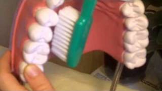 Gum Disease Remedy Receding Gums Treatment [upl. by Cavit]