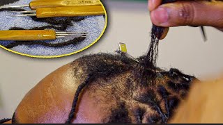 CRAZY DREADLOCK REATTACHMENT  REPAIR  Insane Transformation [upl. by Chrissa]