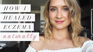 How I Healed Eczema Naturally  My Story [upl. by Aidnyl]