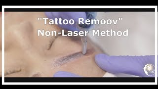 Nonlaser Tattoo Removal by advance nonlaser method quotTattoo Remoovquot  Master Paris Faraji [upl. by Ernesta]