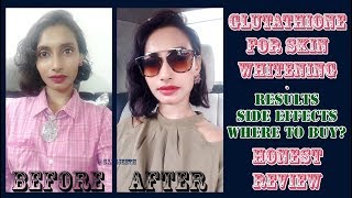 Glutathione Skin Whitening Tablets Results  Genuine Customer Review  SahiJeeth [upl. by Beau431]