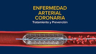 Enfermedad Arterial Coronaria EAC Tratamiento y prevención [upl. by Egedan]